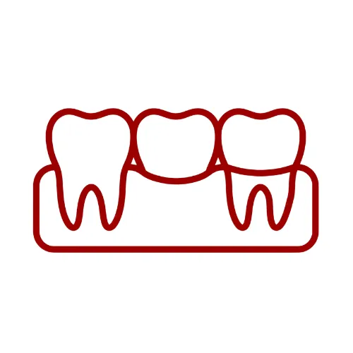 Clinica Dental Tena Zaragozaprotesis Dental