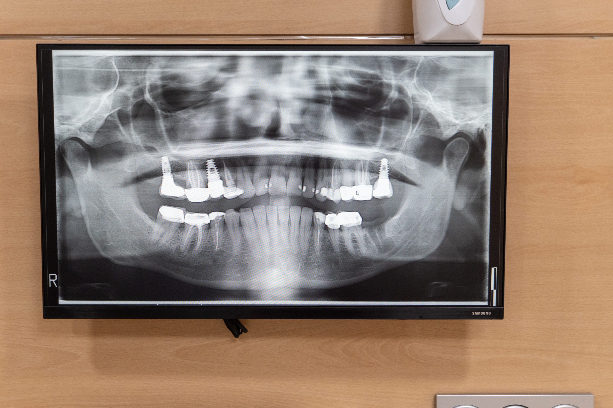 clinica-dental-vinaros-328